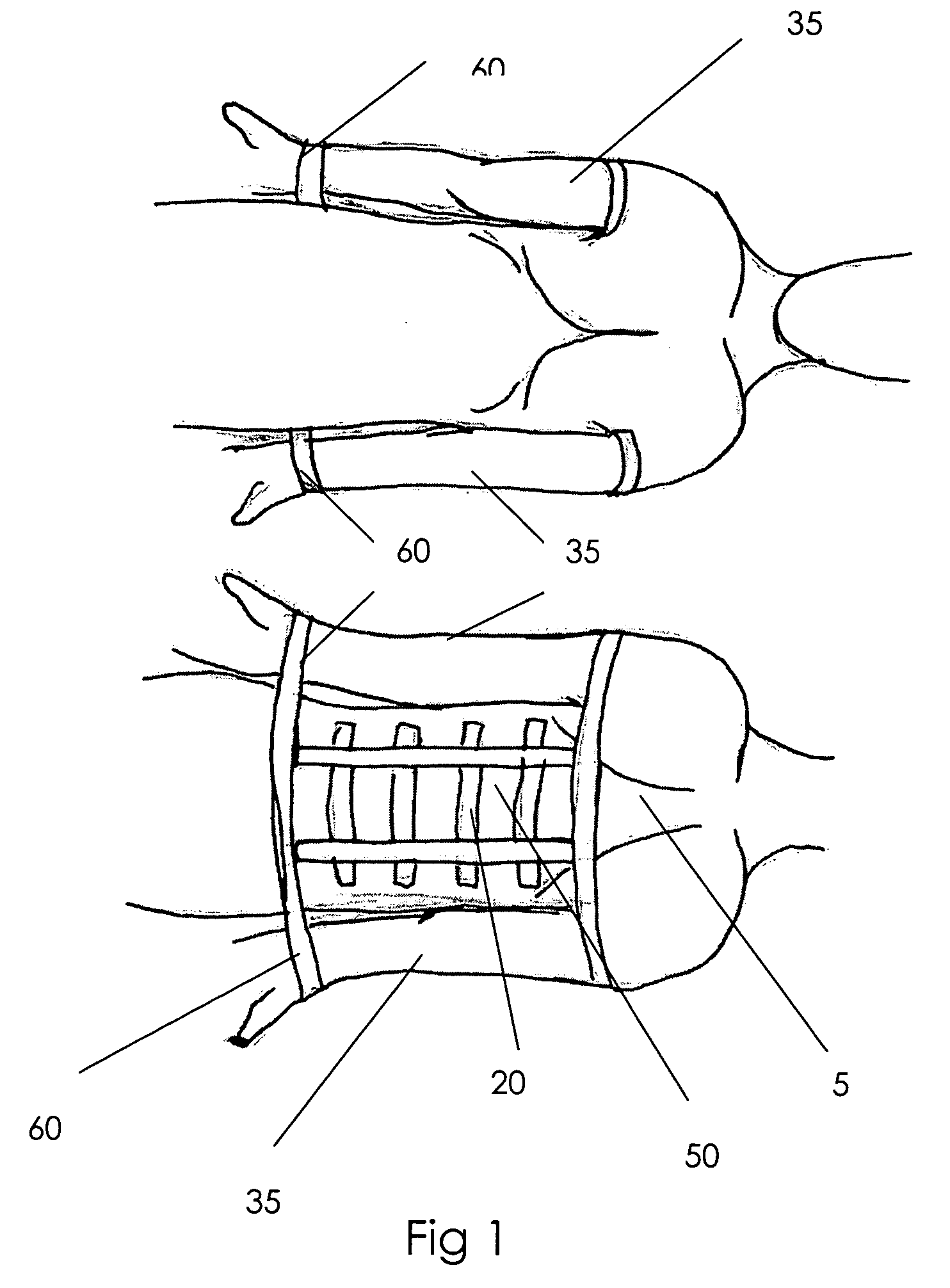 Altered range of motion device