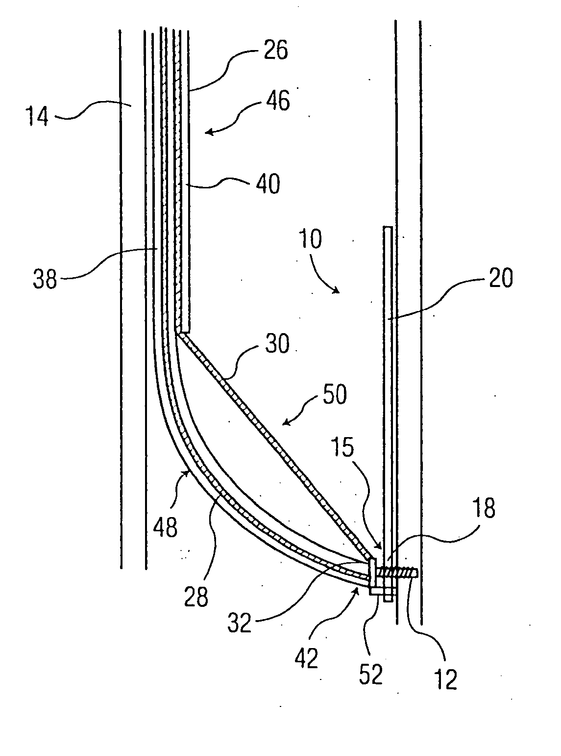 Implantable valve system