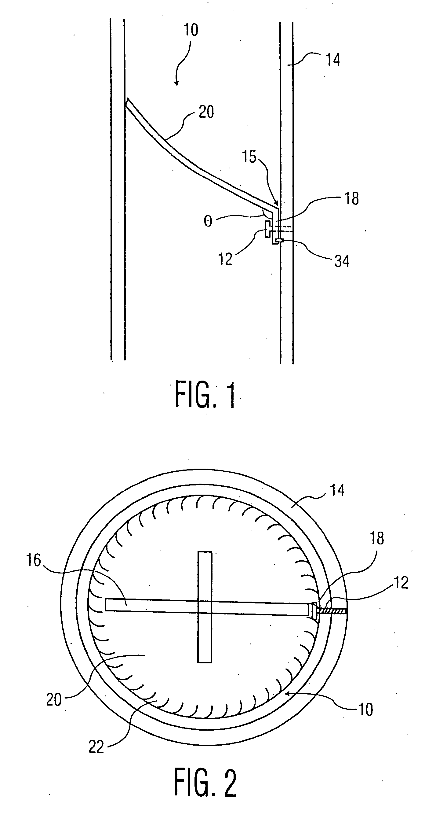 Implantable valve system