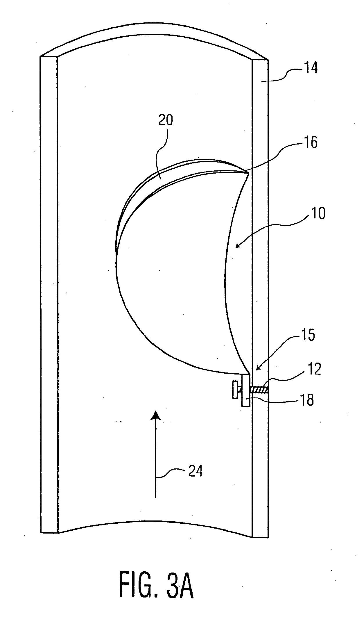 Implantable valve system