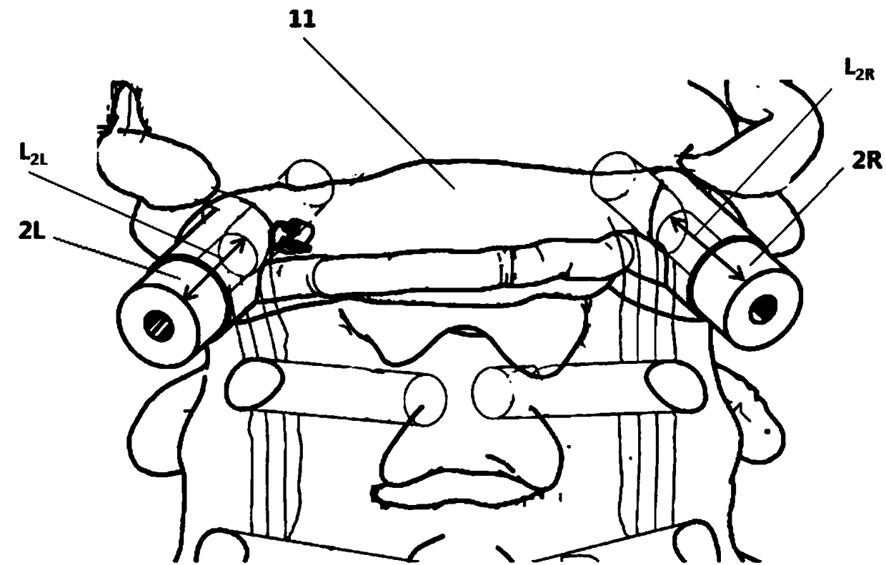 Screw placing guide plate for spine and manufacturing method of screw placing guide plate