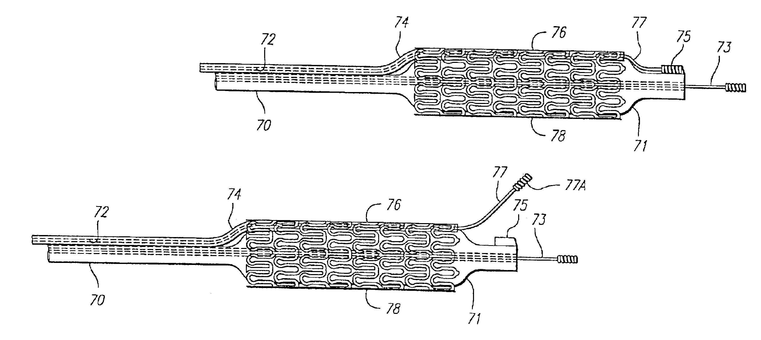 Stent and catheter assembly and method for treating bifurcations