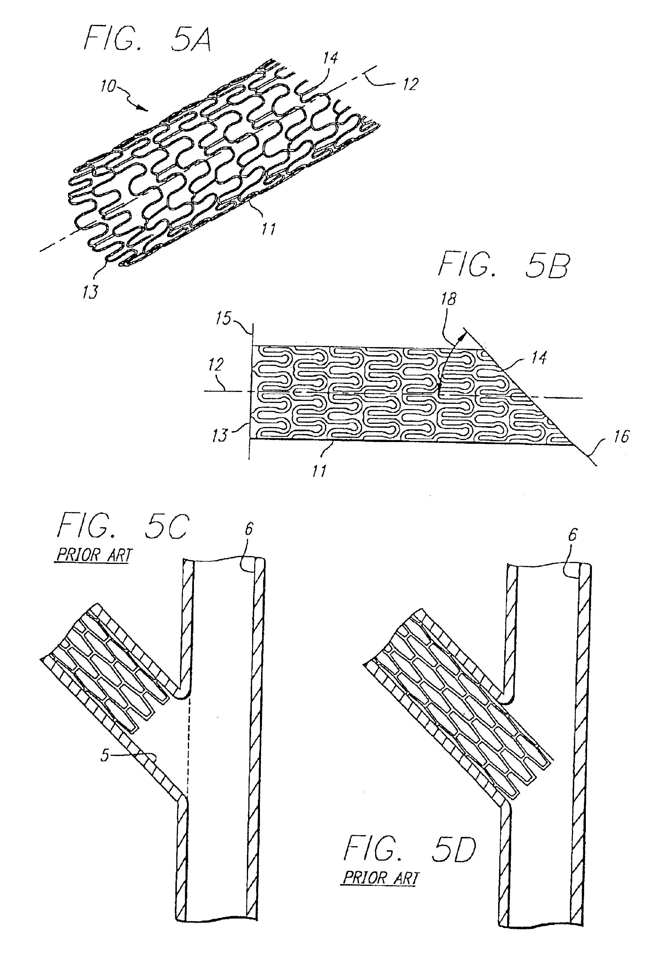 Stent and catheter assembly and method for treating bifurcations