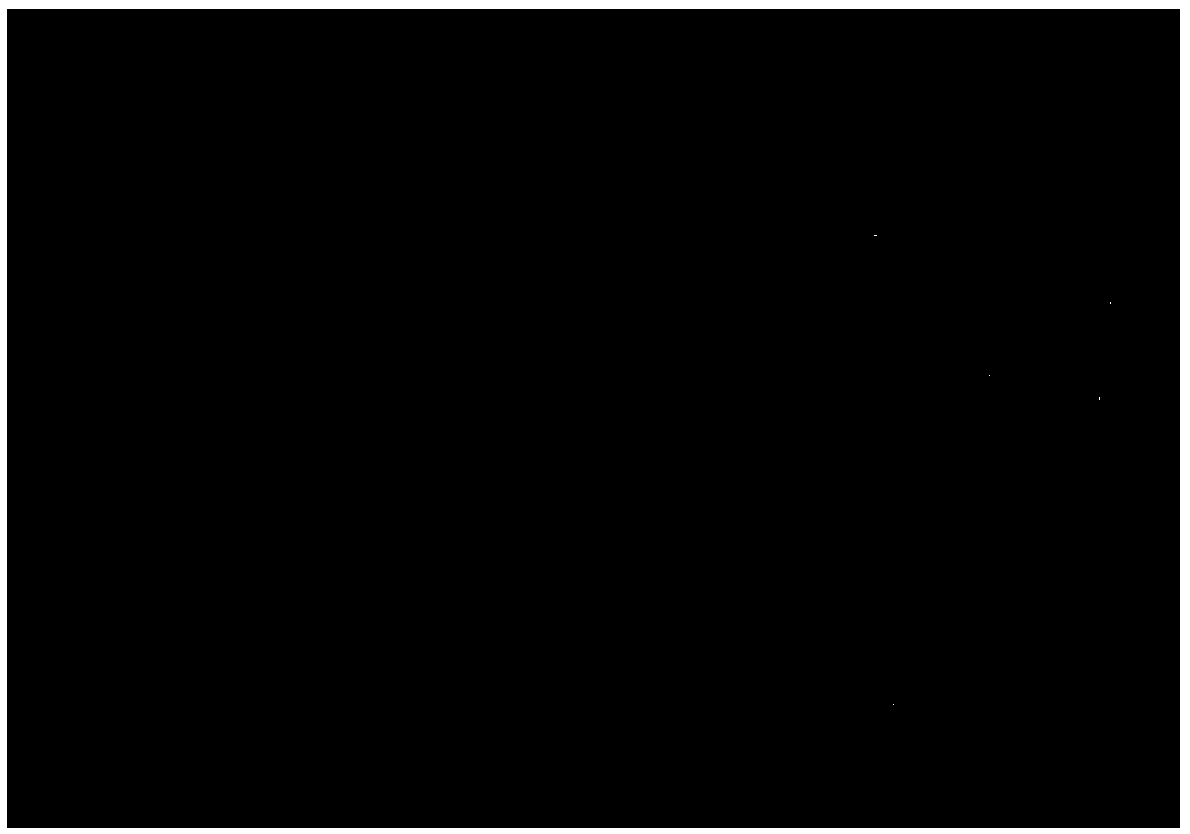 Preparation method of decellularized derma matrix of human source