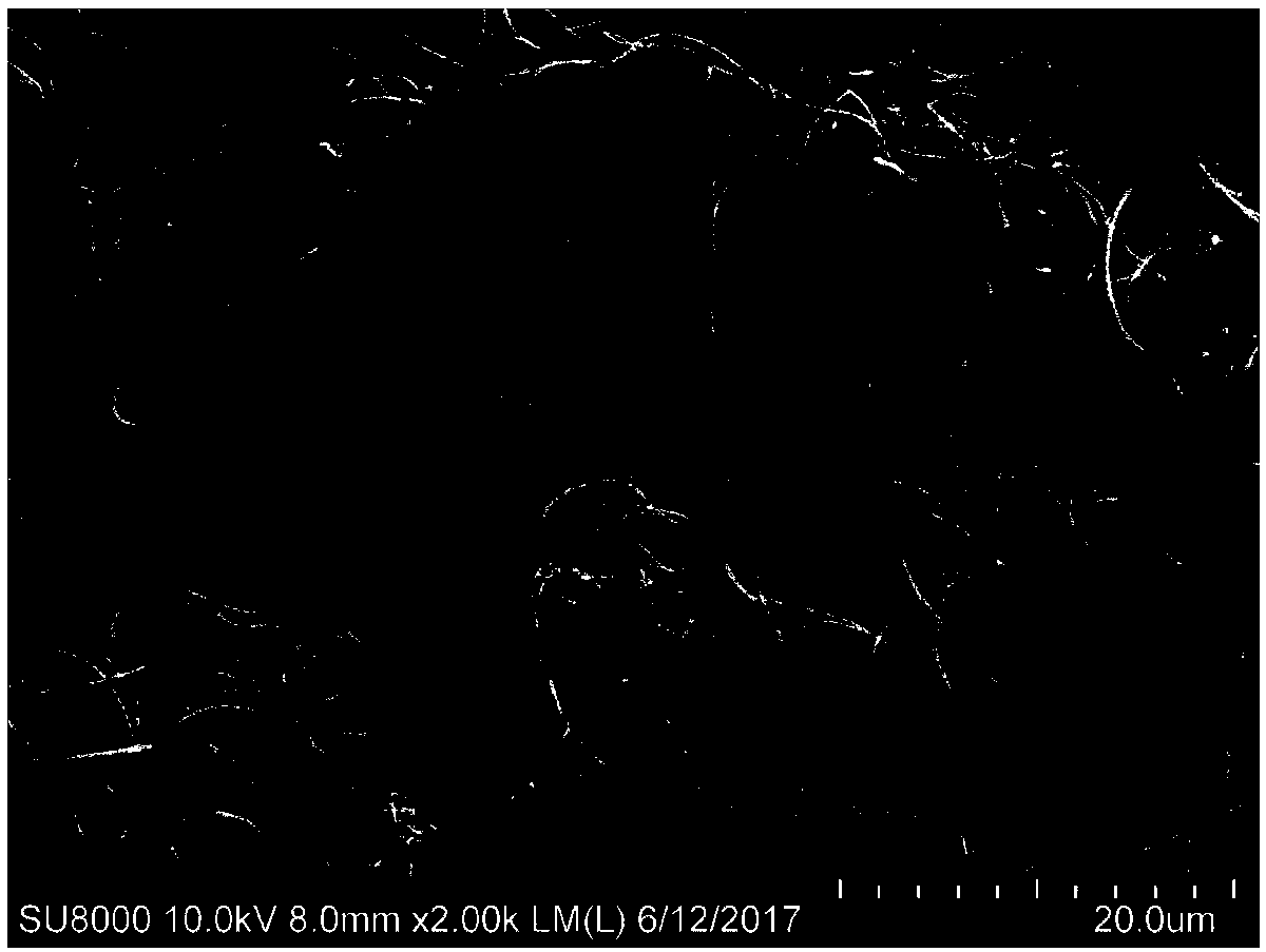 Preparation method of decellularized derma matrix of human source