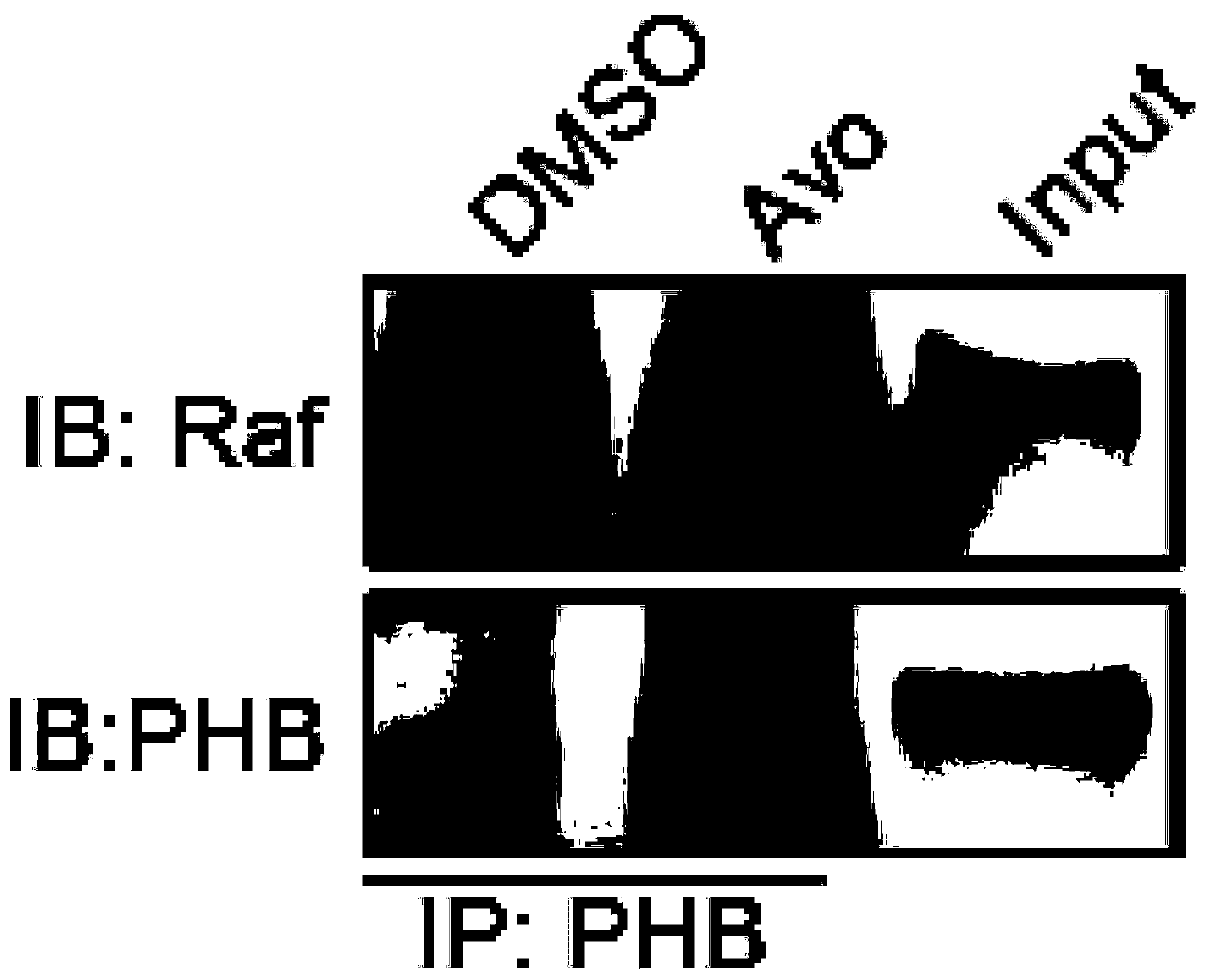 Application of avobenzone in the preparation of antitumor drugs