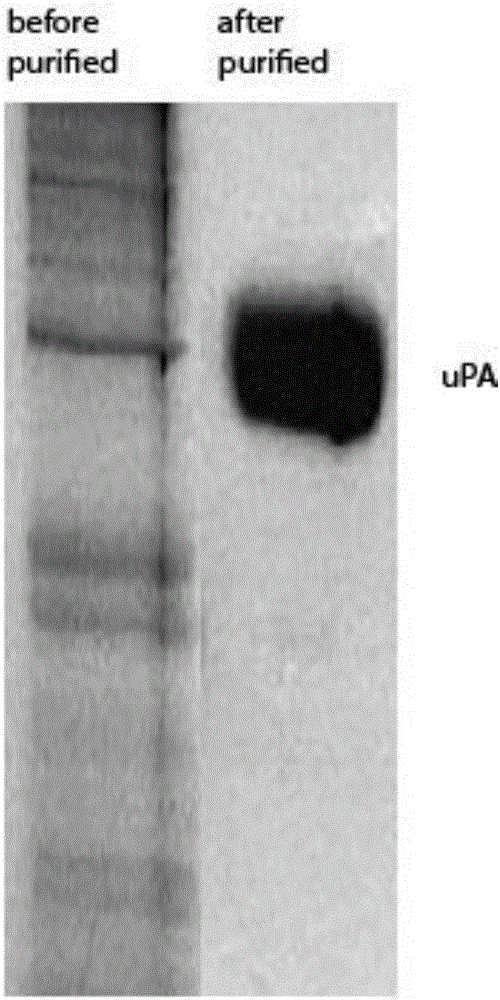 Preparation method of urokinase