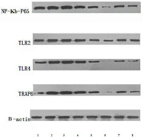 Application of cancerous toxin prescription in aspect of preparing medicament for adjusting and controlling signal transduction hepatoma cell TLRs/NF-kB