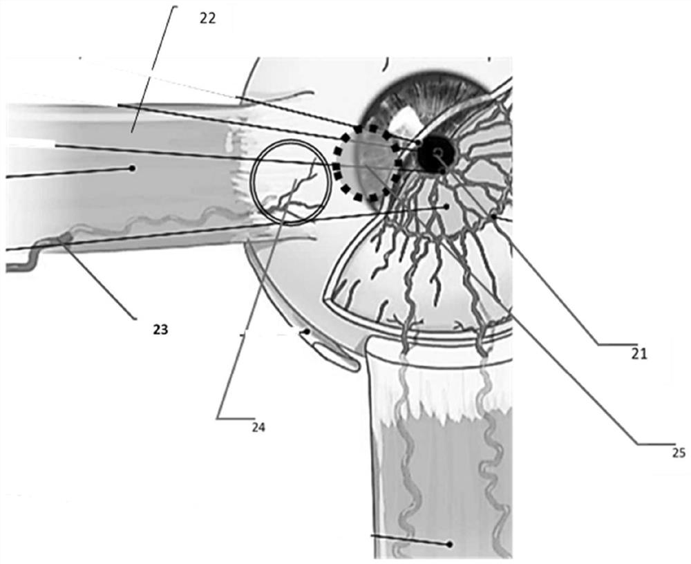 System and method for determining intraocular pressure