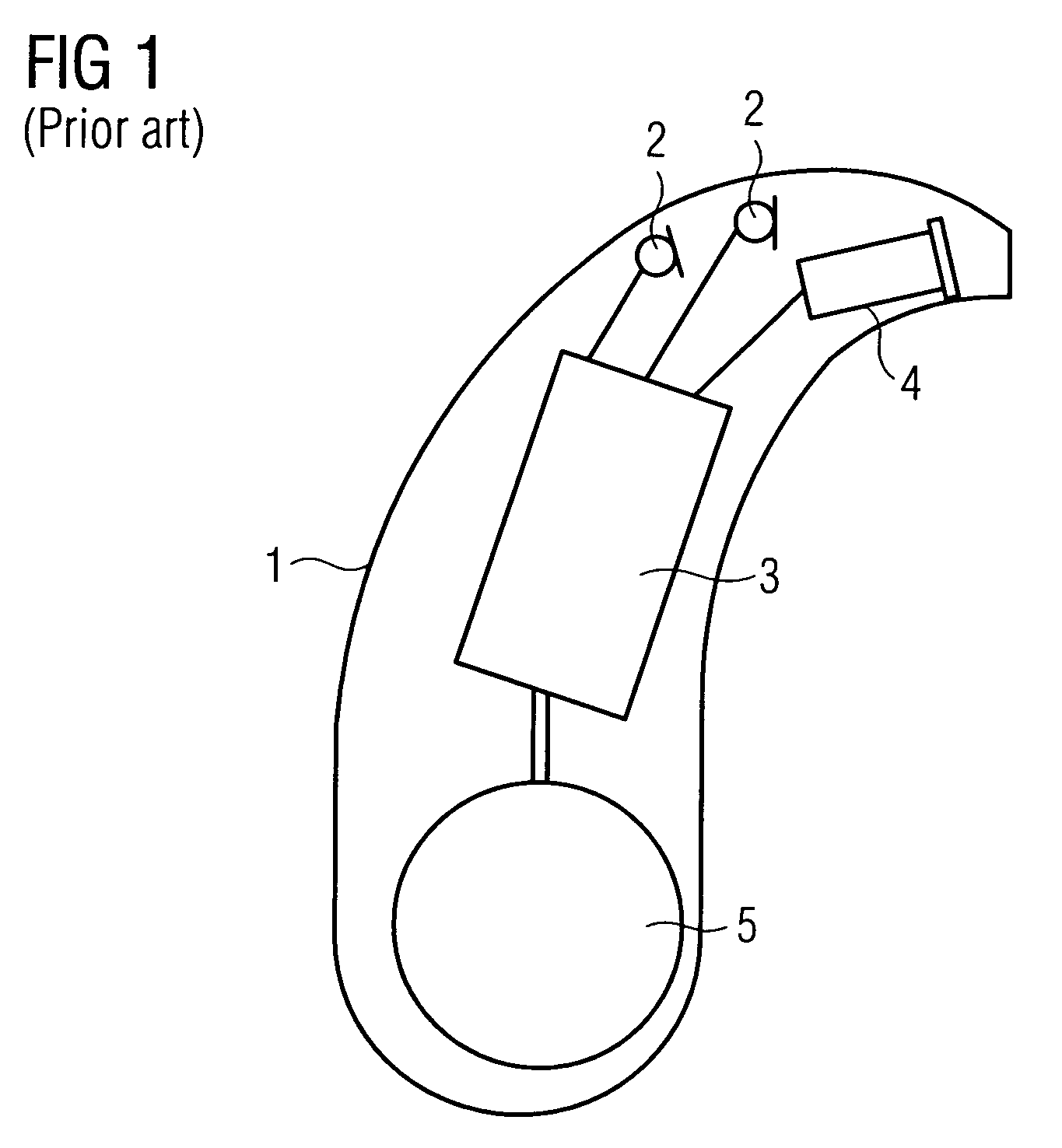 Multi-stage estimation method for noise reduction and hearing apparatus