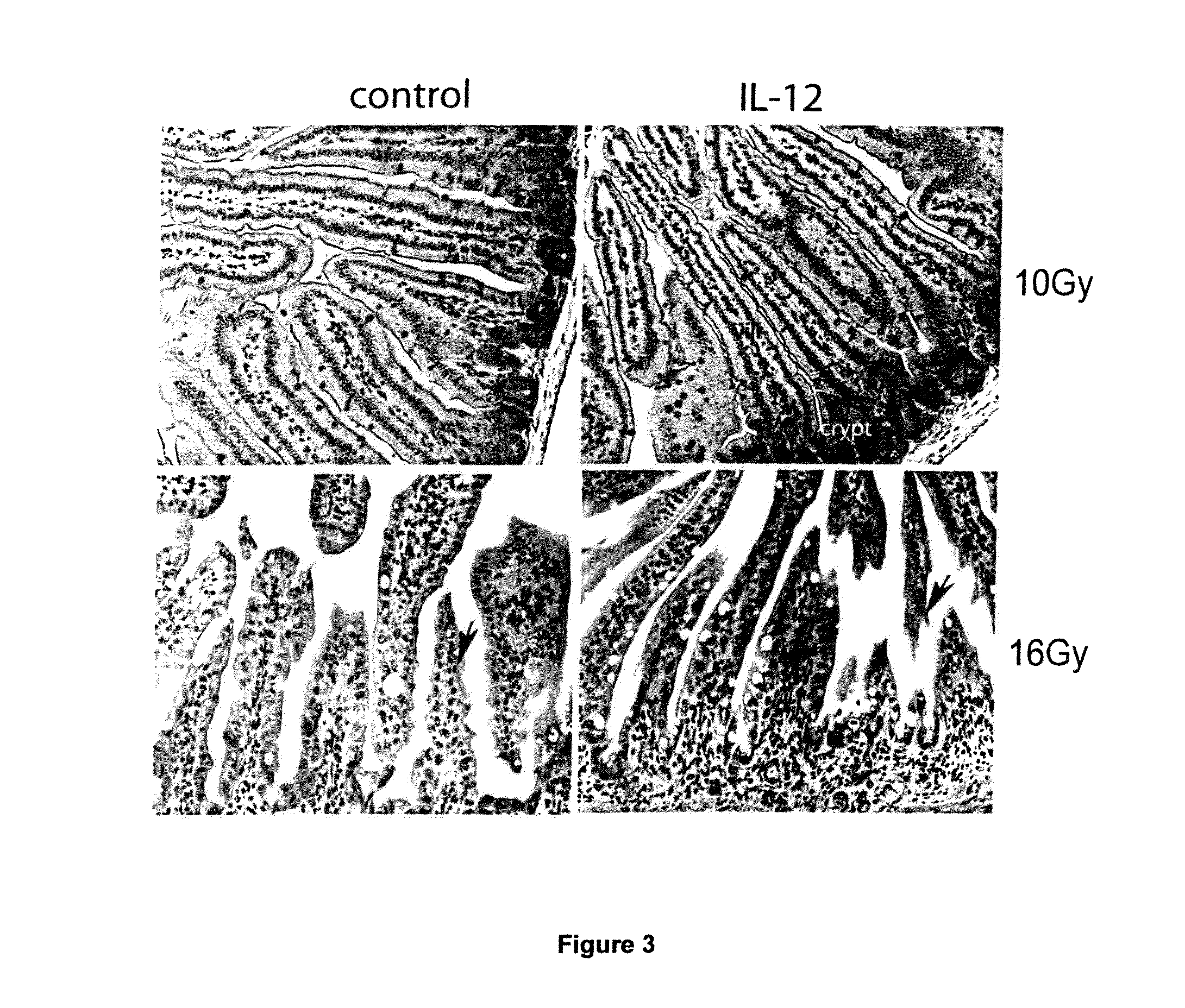 Method for treating deficiency in hematopoiesis