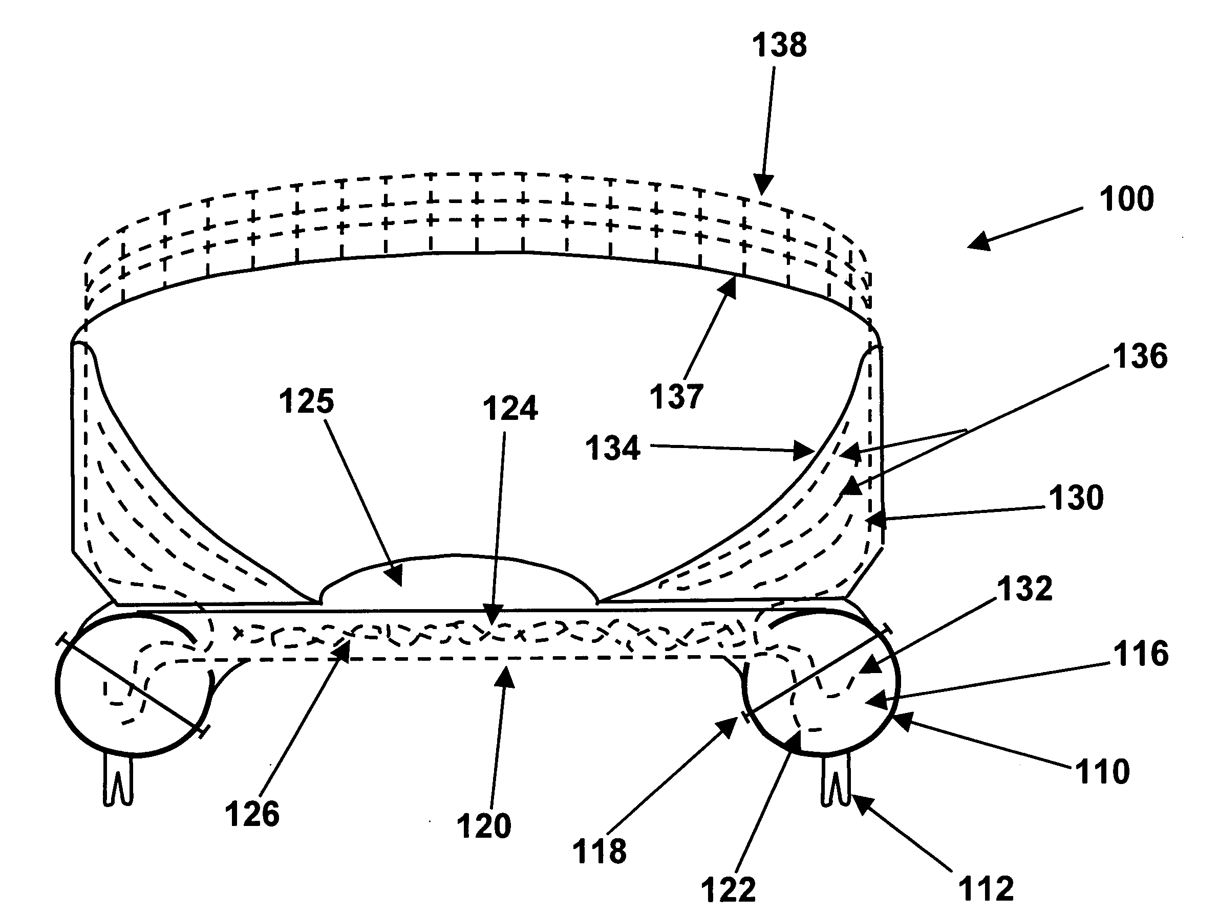 Multi-part implants for combined repair of hyaline and meniscal cartilage in joints