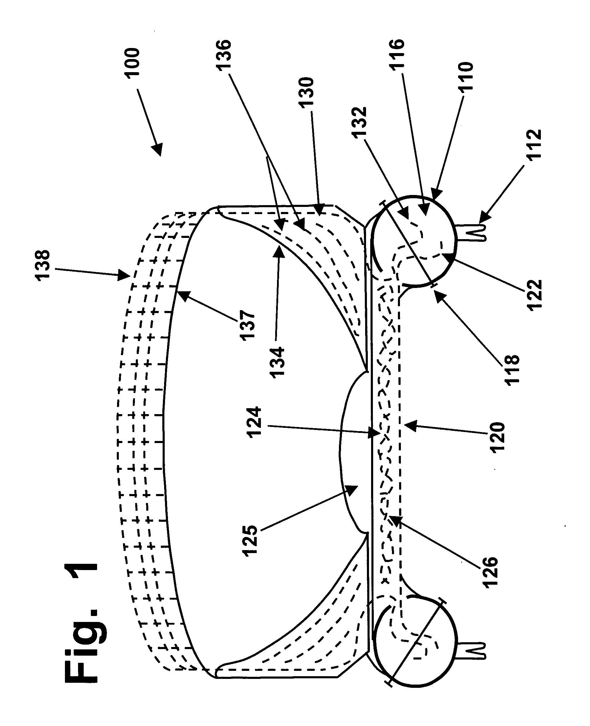 Multi-part implants for combined repair of hyaline and meniscal cartilage in joints