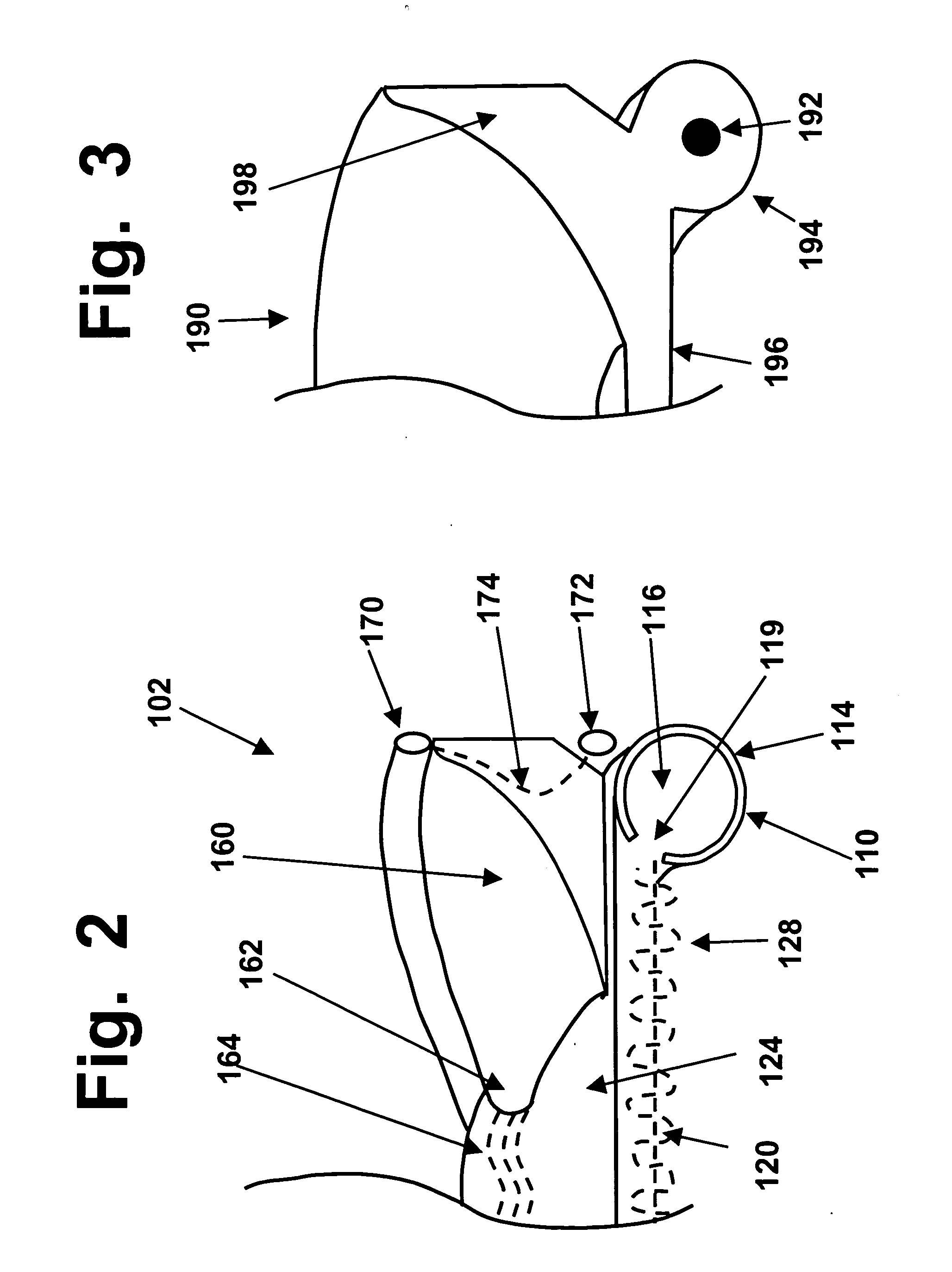 Multi-part implants for combined repair of hyaline and meniscal cartilage in joints