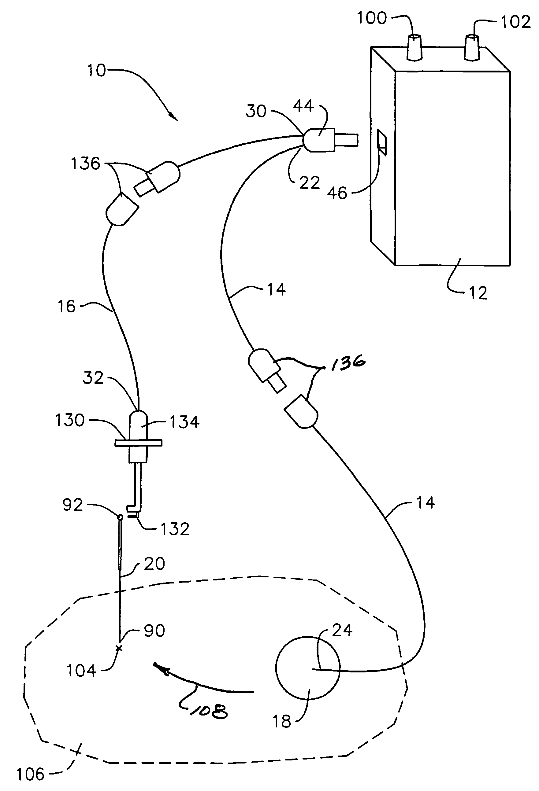 Electro-nerve stimulator system and methods