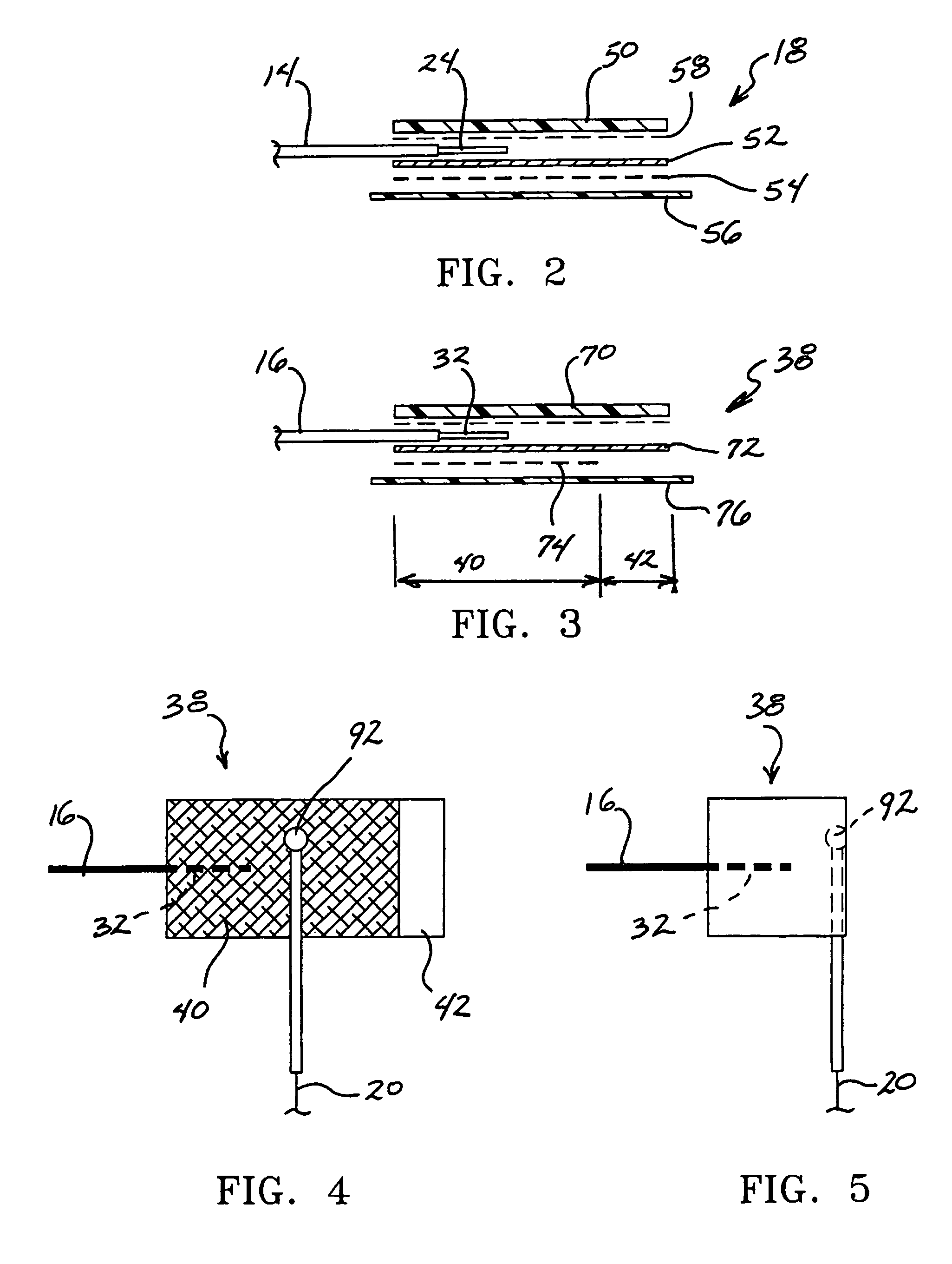 Electro-nerve stimulator system and methods