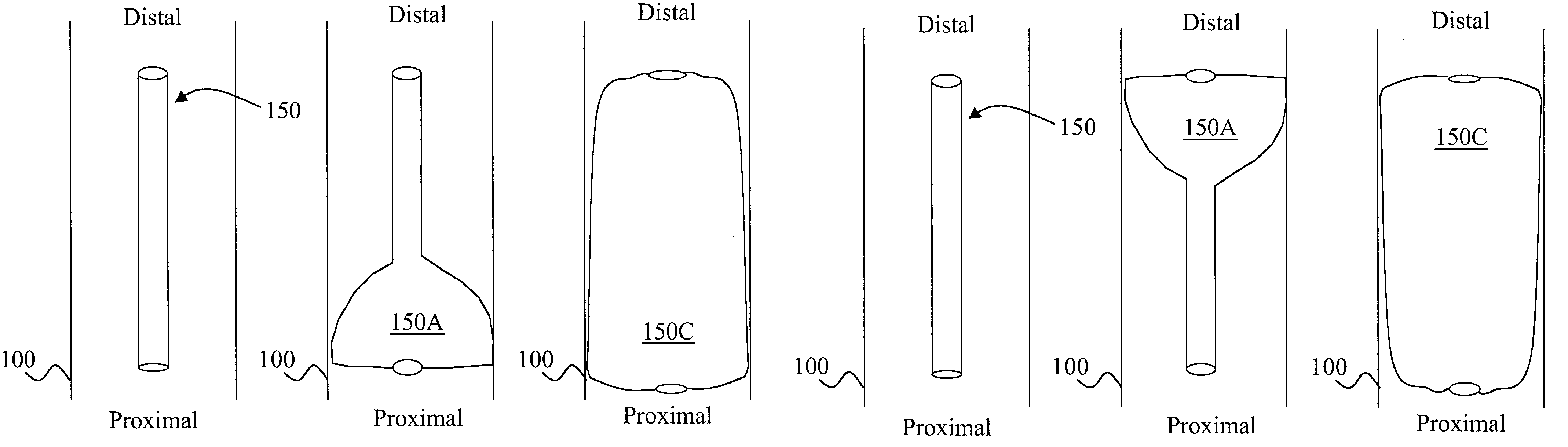 Device and method for medical interventions of body lumens