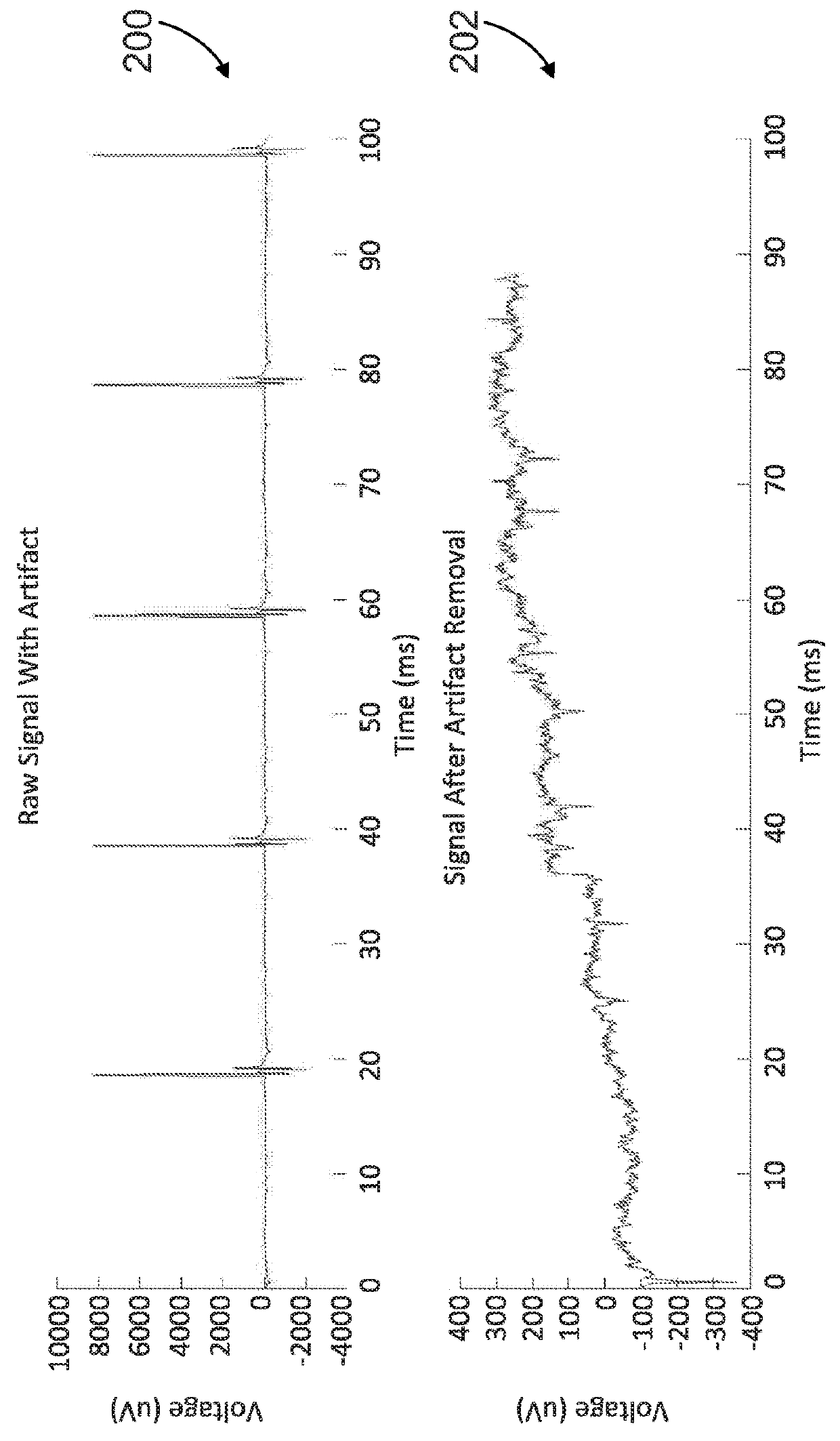 Systems for neural bridging of the nervous system