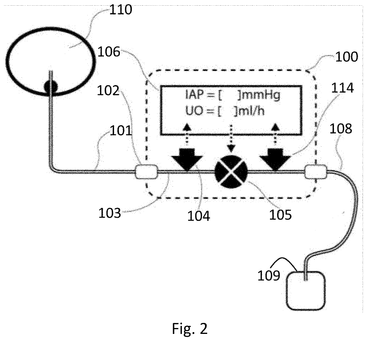 Apparatus and method of monitoring intra-abdominal pressure and urine output