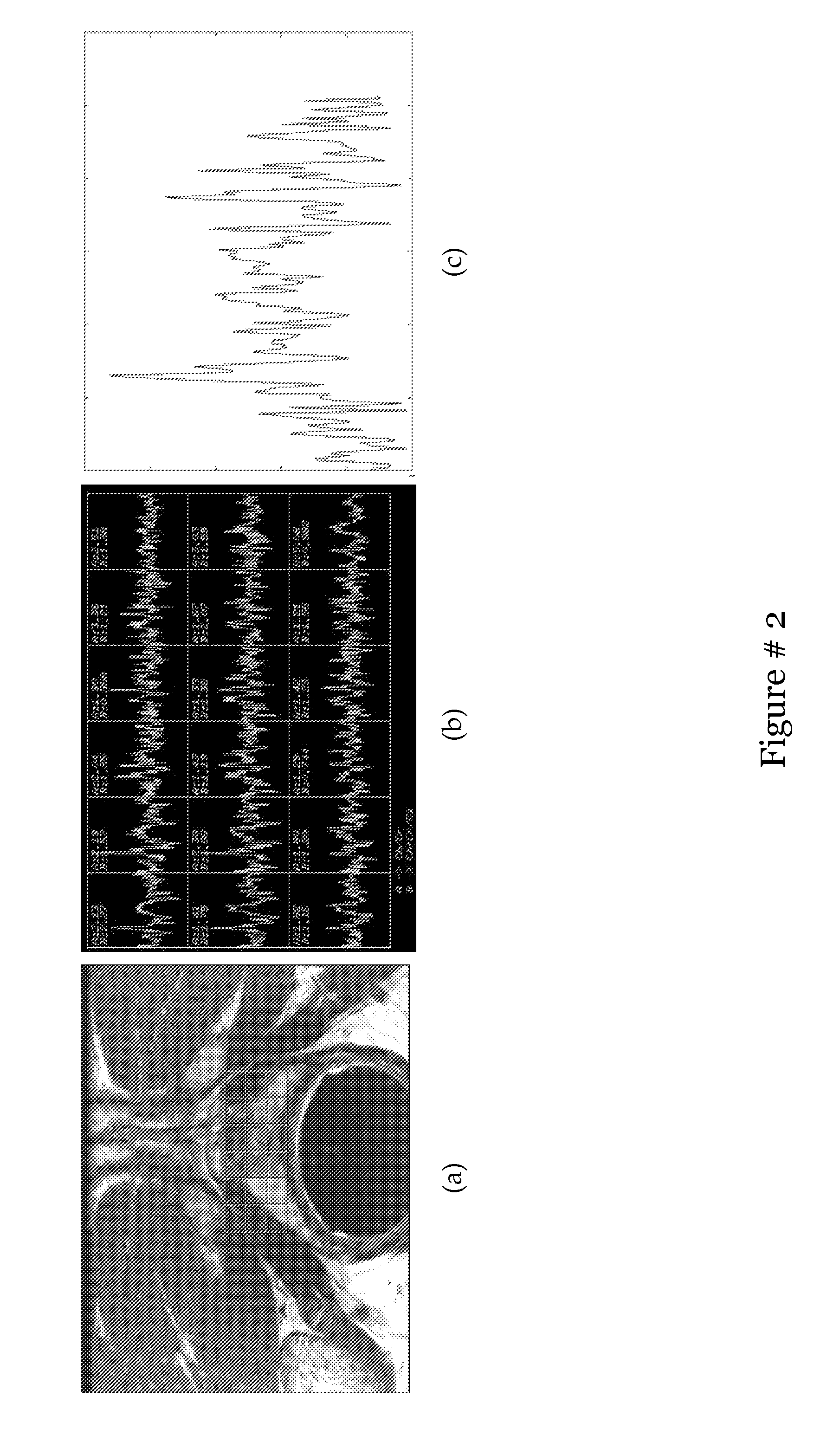 Computer assisted diagnosis (CAD) of cancer using multi-functional, multi-modal in-vivo magnetic resonance spectroscopy (MRS) and imaging (MRI)