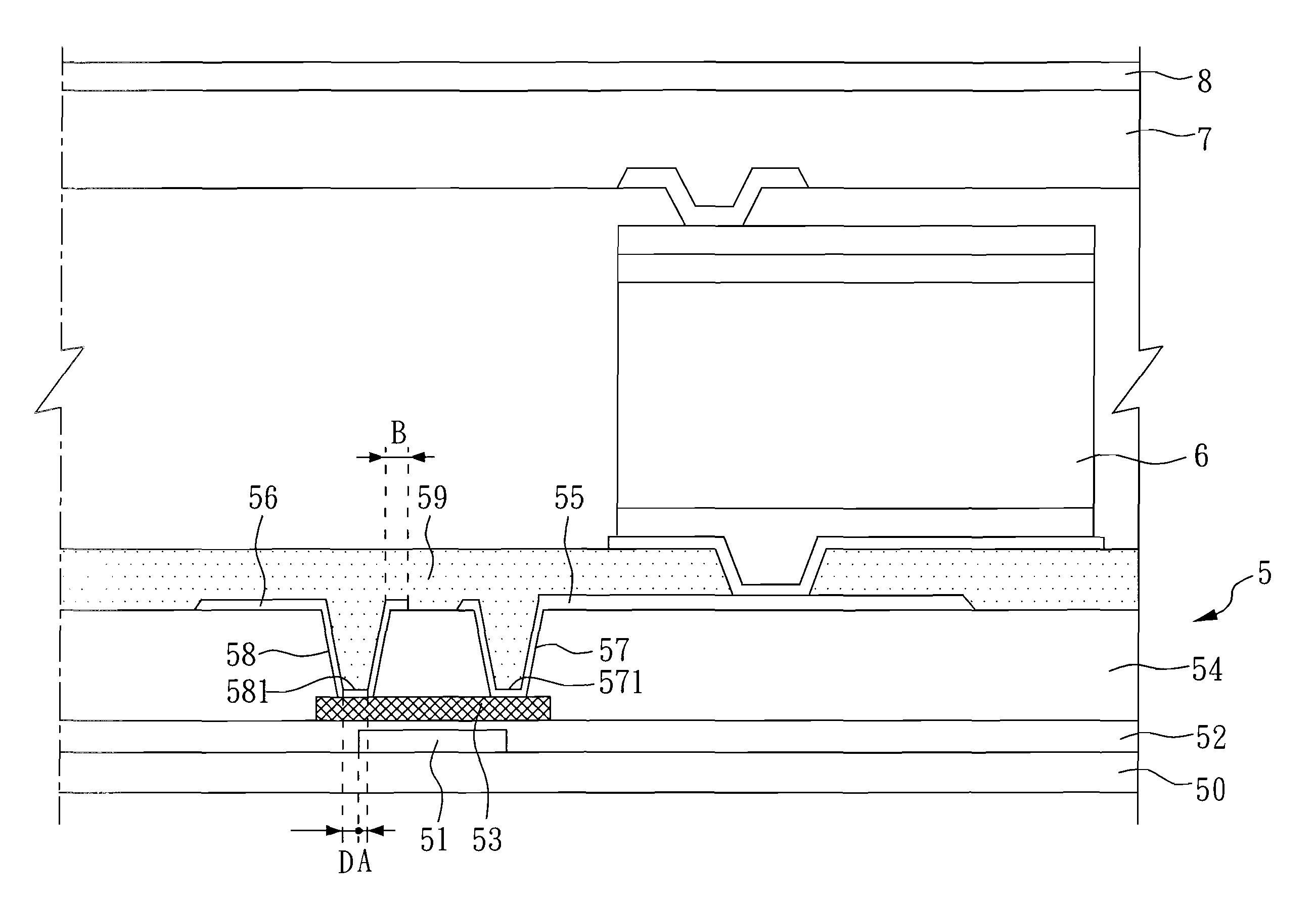 X-ray detector