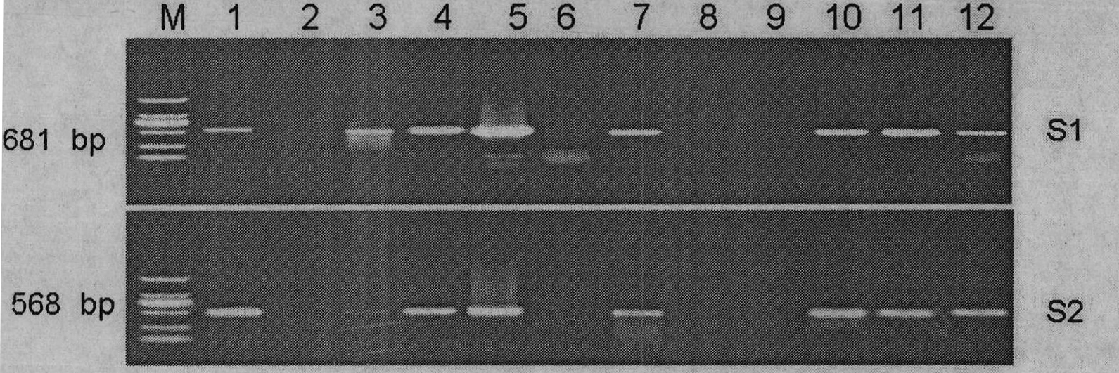 Kit and method for detecting virus infecting situation of Chinese giant salamander colony iridovirus by use of ecdysis