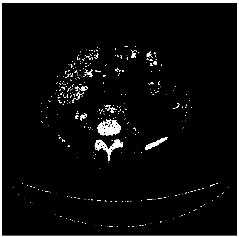 medical PET image denoising method based on frequency domain direction smoothing Shearlet