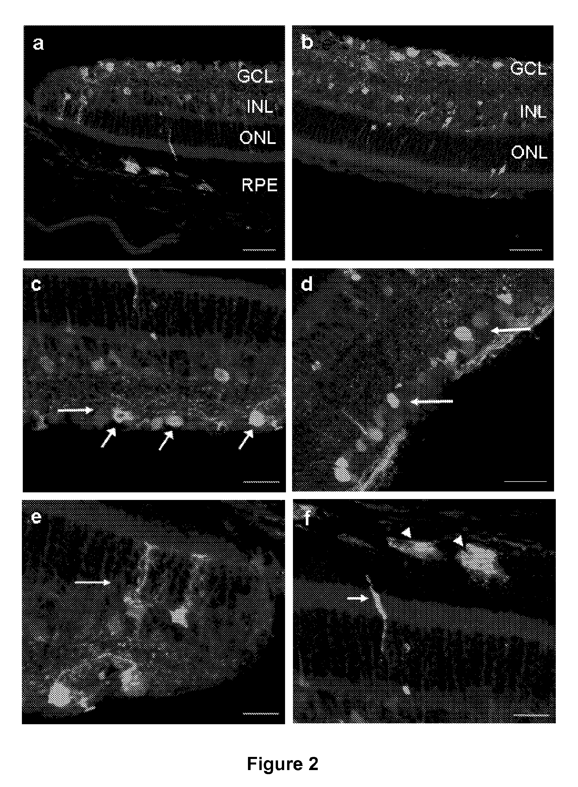 Widespread gene delivery to the retina using systemic administration of AAV vectors