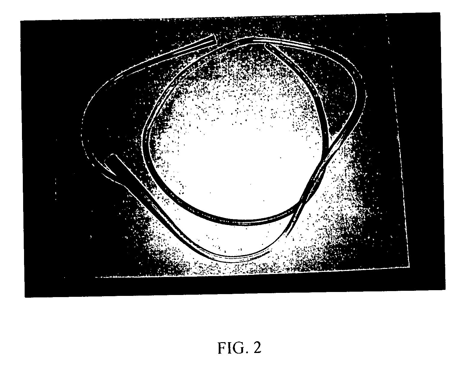 Color-coded medical tubes and post-insertion monitoring thereof