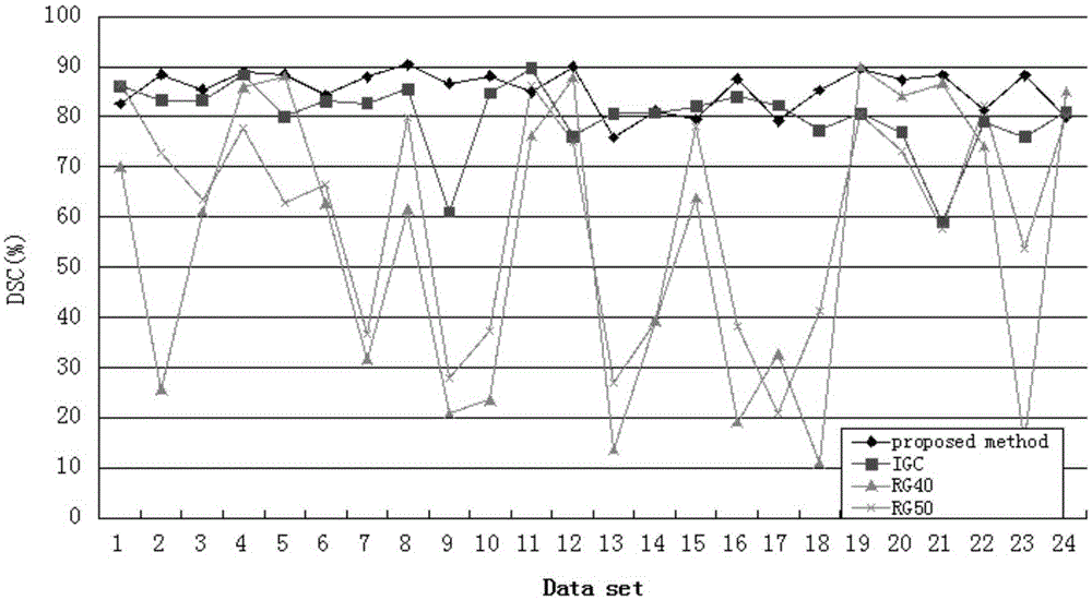 Automatic lung tumour segmentation method based on random forest and monotonically decreasing function