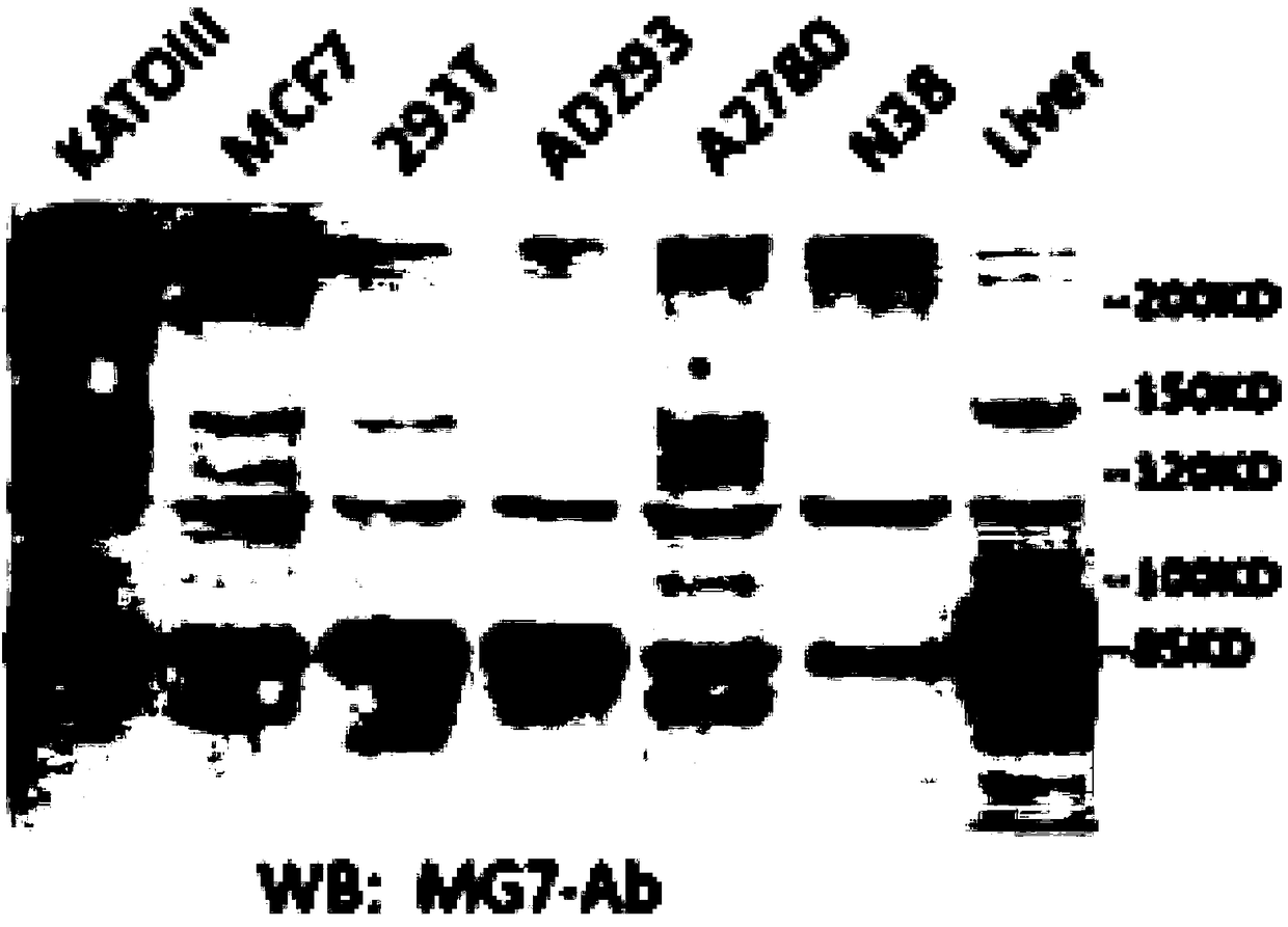 Anti-human CEACAM5 monoclonal antibody and preparation method and application thereof