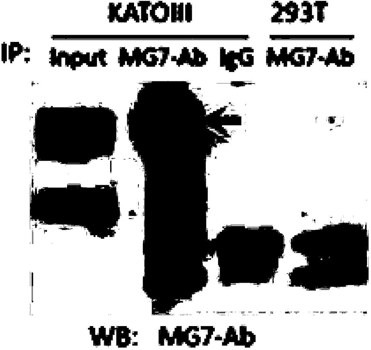 Anti-human CEACAM5 monoclonal antibody and preparation method and application thereof