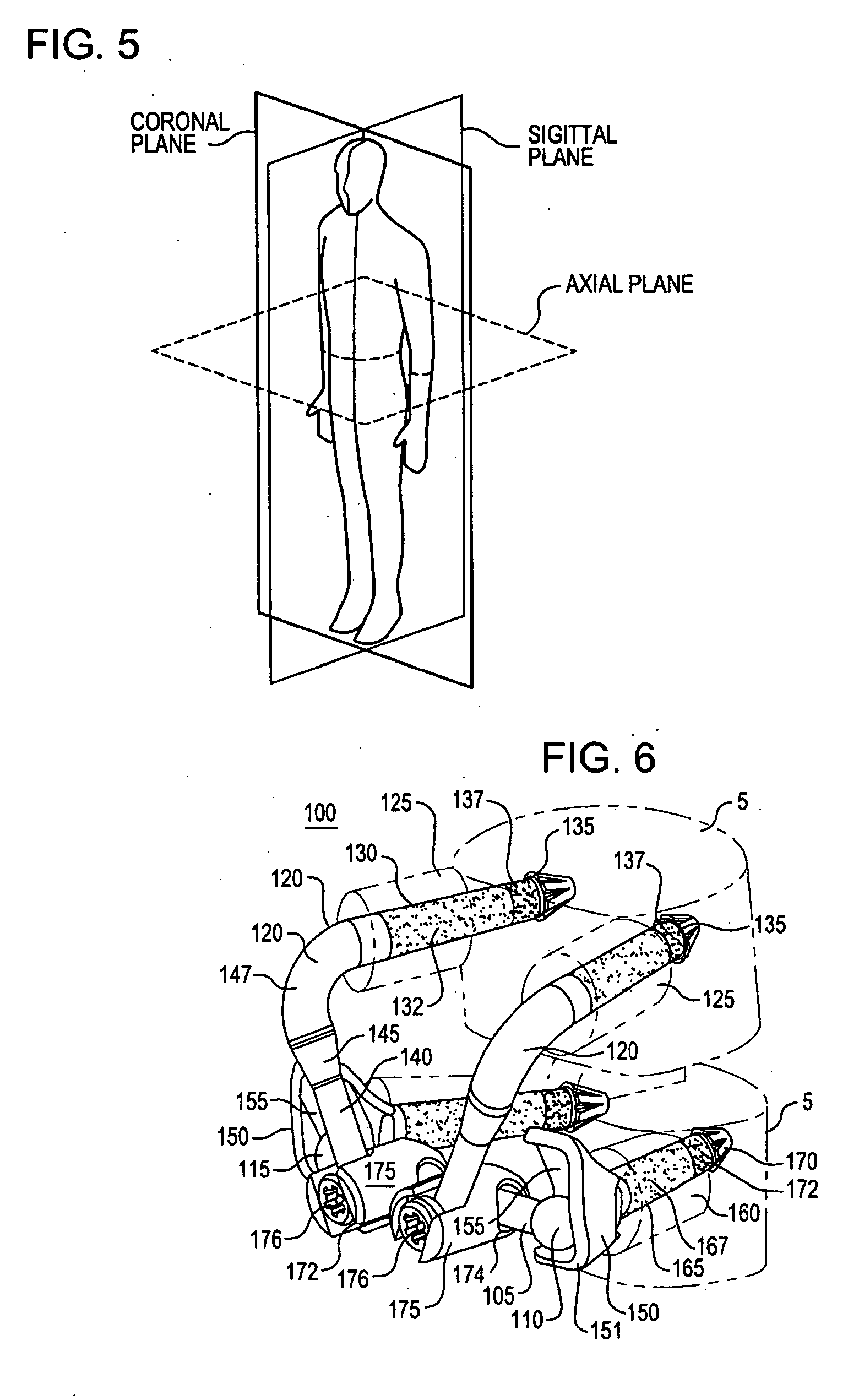 Crossbar spinal prosthesis having a modular design and related implantation methods