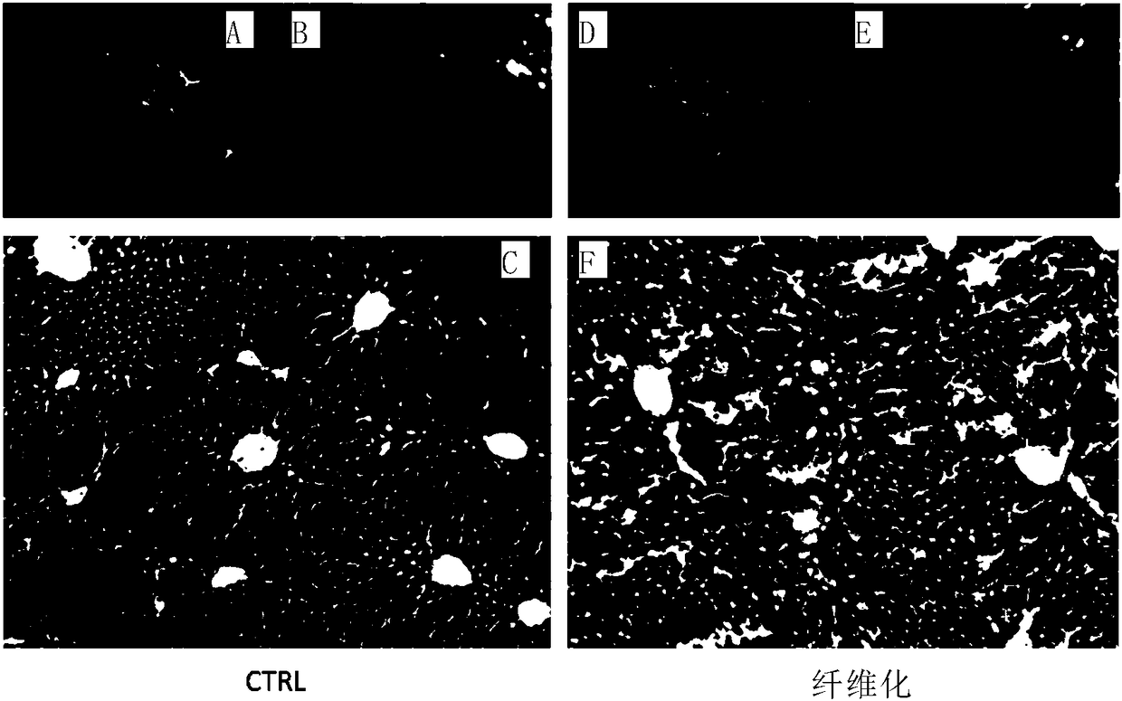 Small-molecule compound for inhibiting liver fibrosis and application thereof