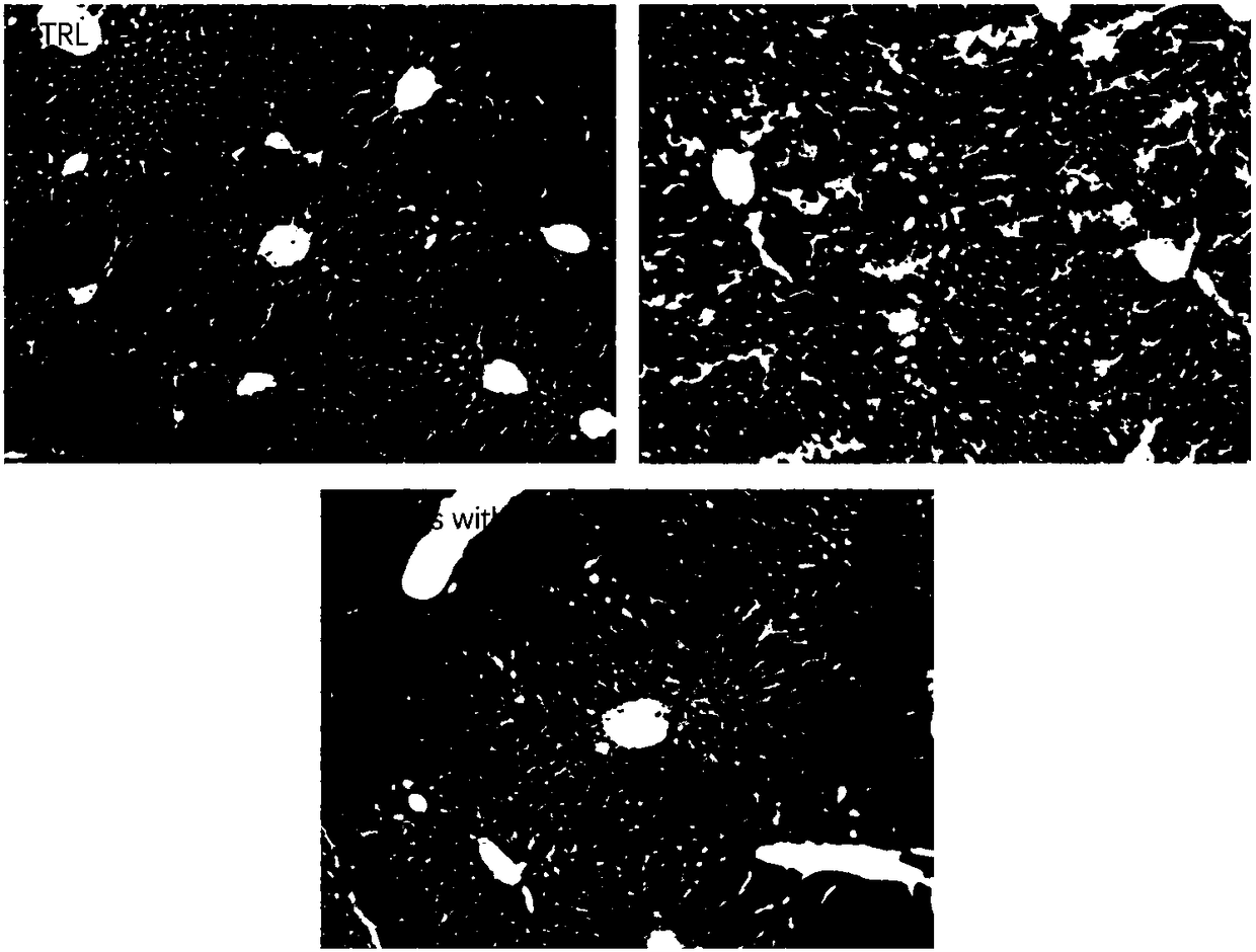 Small-molecule compound for inhibiting liver fibrosis and application thereof