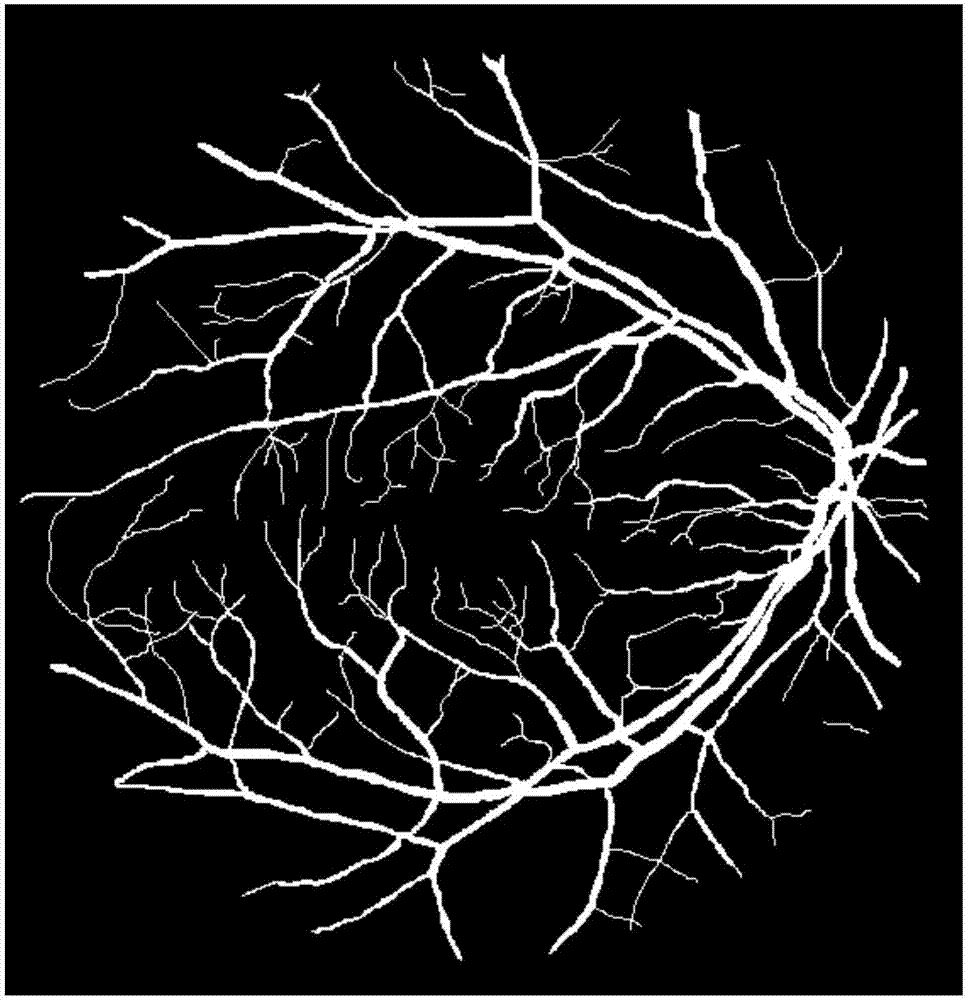 Eye fundus image based three-dimensional model building method and device for retinal vessel