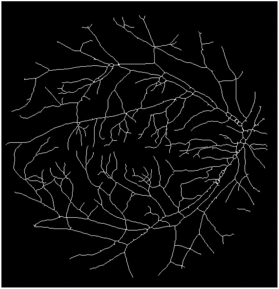 Eye fundus image based three-dimensional model building method and device for retinal vessel