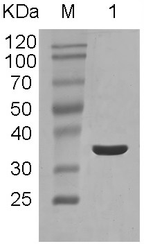 Anti-trichina small heat shock protein egg yolk antibody as well as preparation method and application thereof