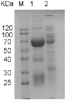 Anti-trichina small heat shock protein egg yolk antibody as well as preparation method and application thereof