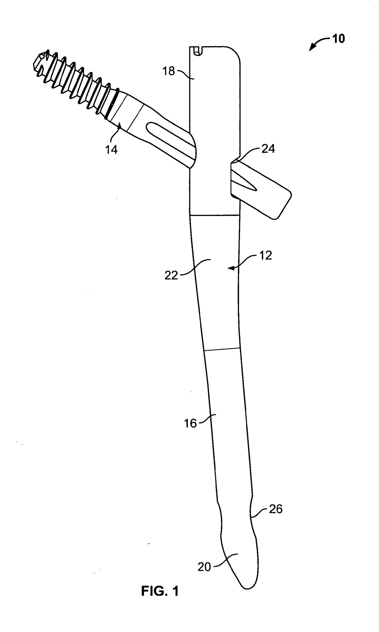 Implant system for bone fixation