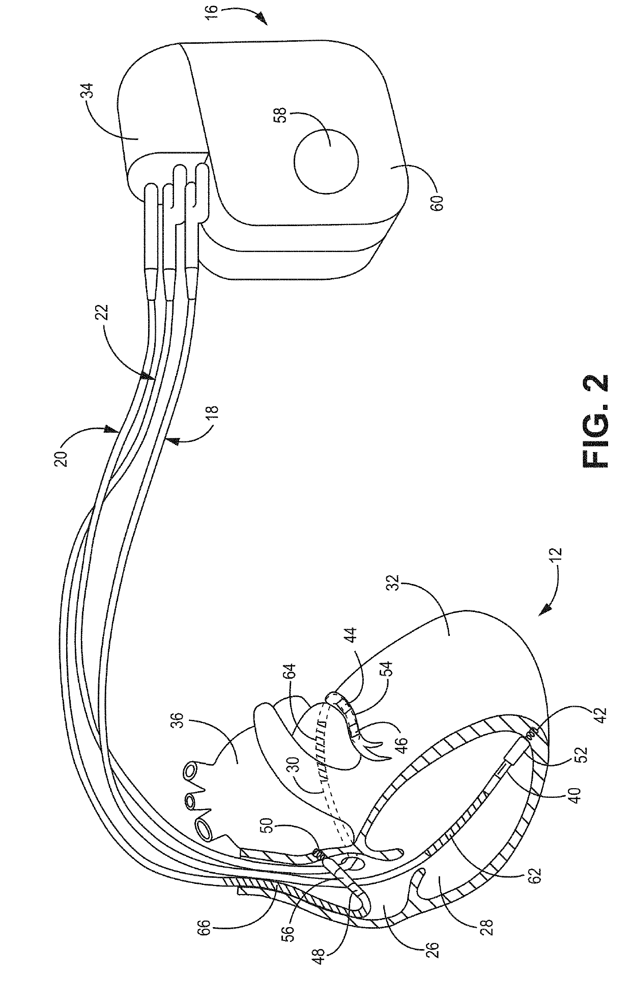 Medical system for therapy adjustment