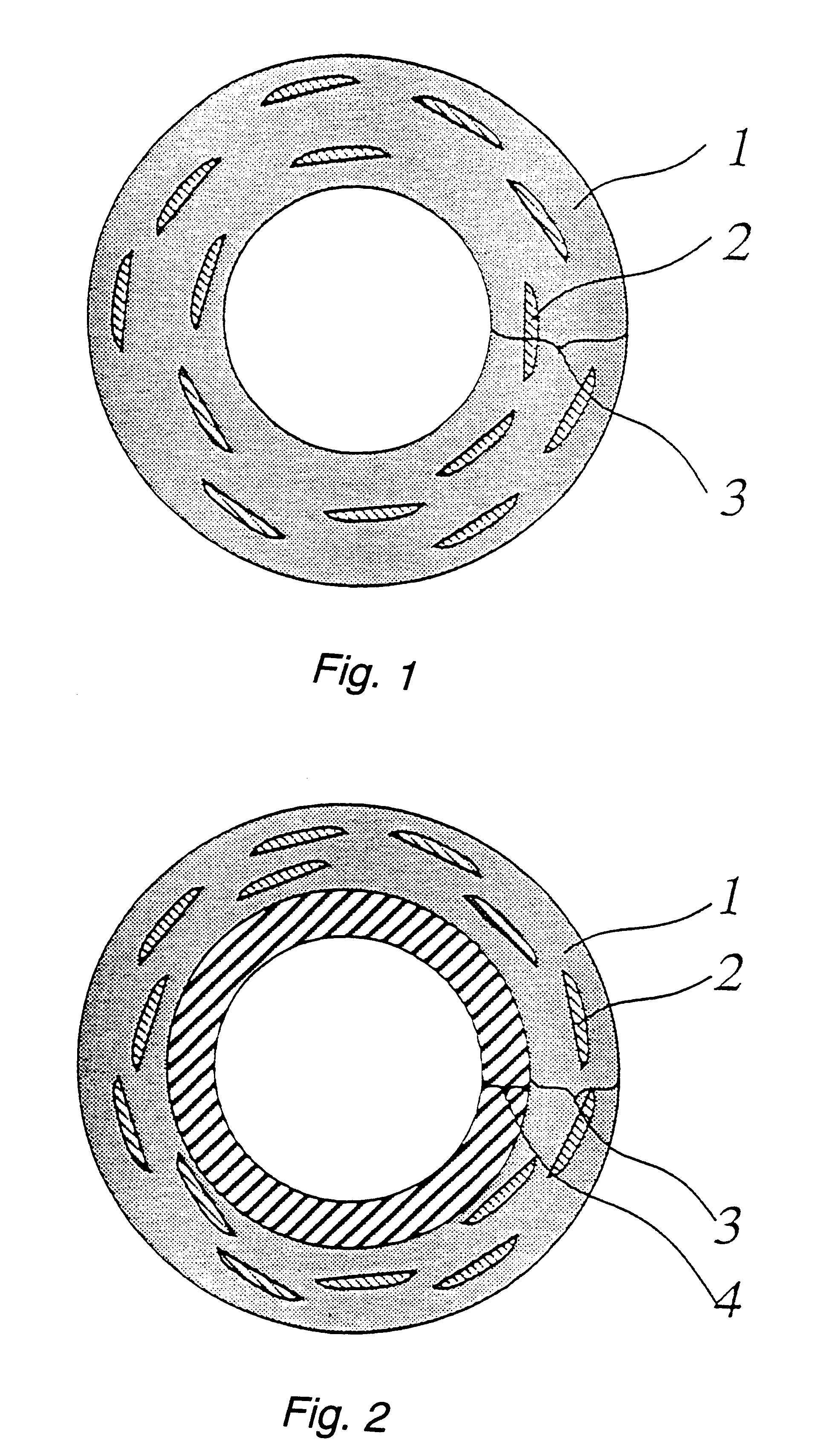 Hybrid fiber-reinforced plastic