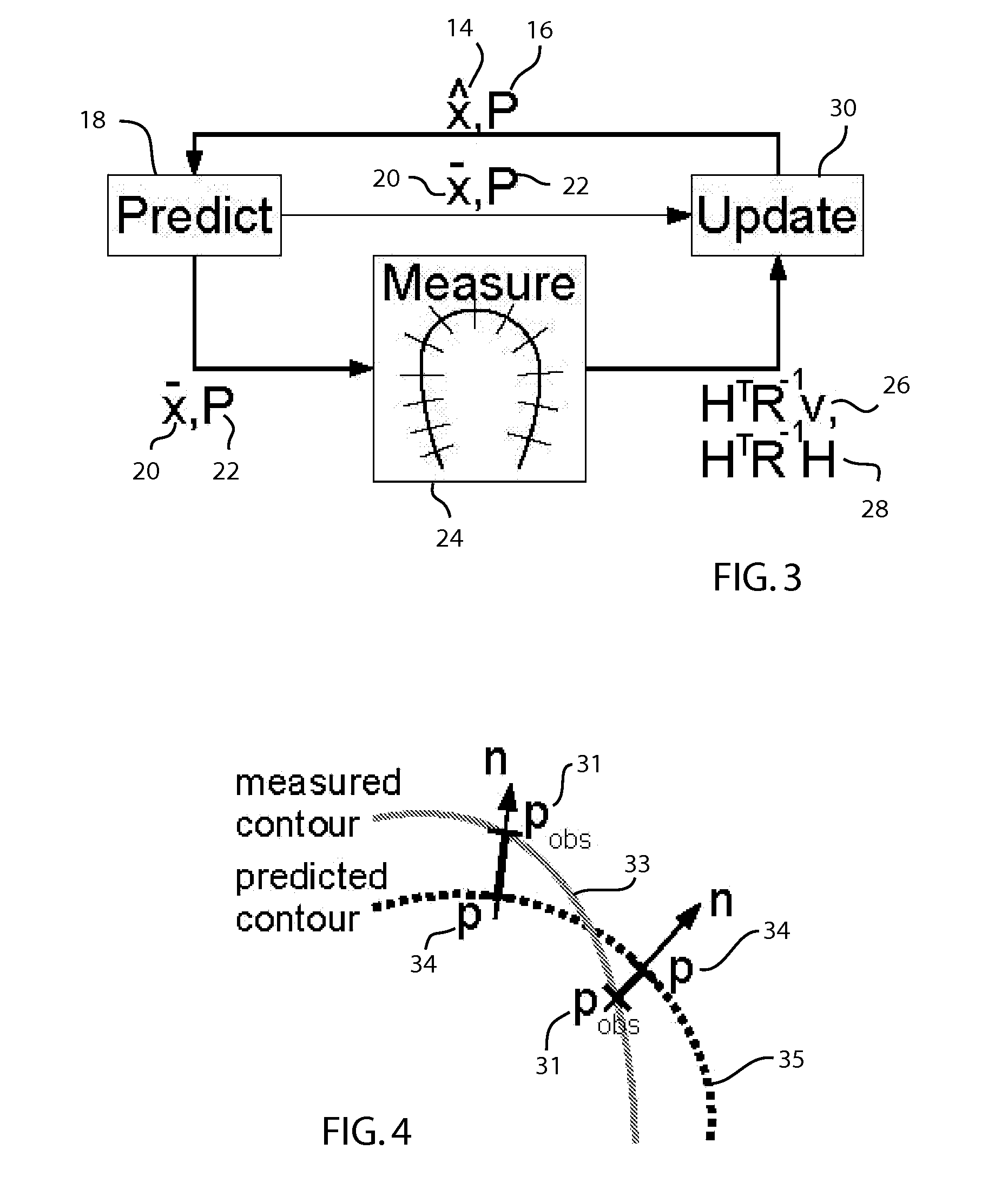 Method for real-time tracking of cardiac structures in 3D echocardiography