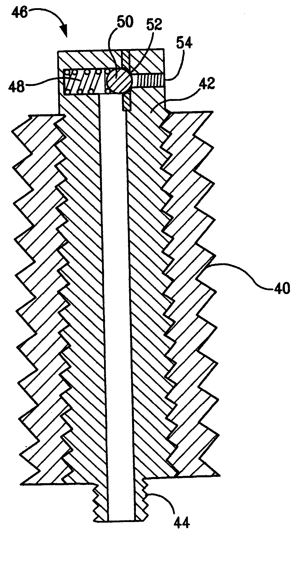 Apparatus and method for movement of electricity or fluid into and out of the body