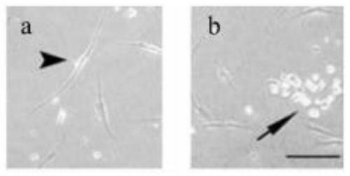 Method for inducing differentiation from neuroblastoma cells to neurons