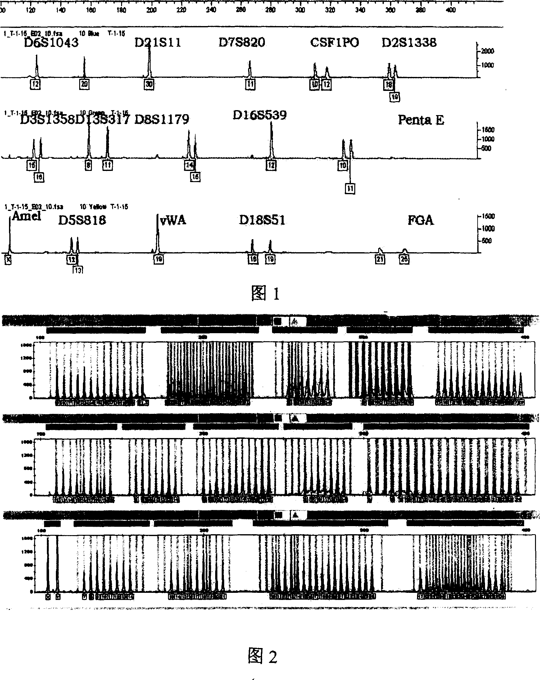 Complex aplification detecting system of fluorescent marker short tandem repetitive sequence gene locus