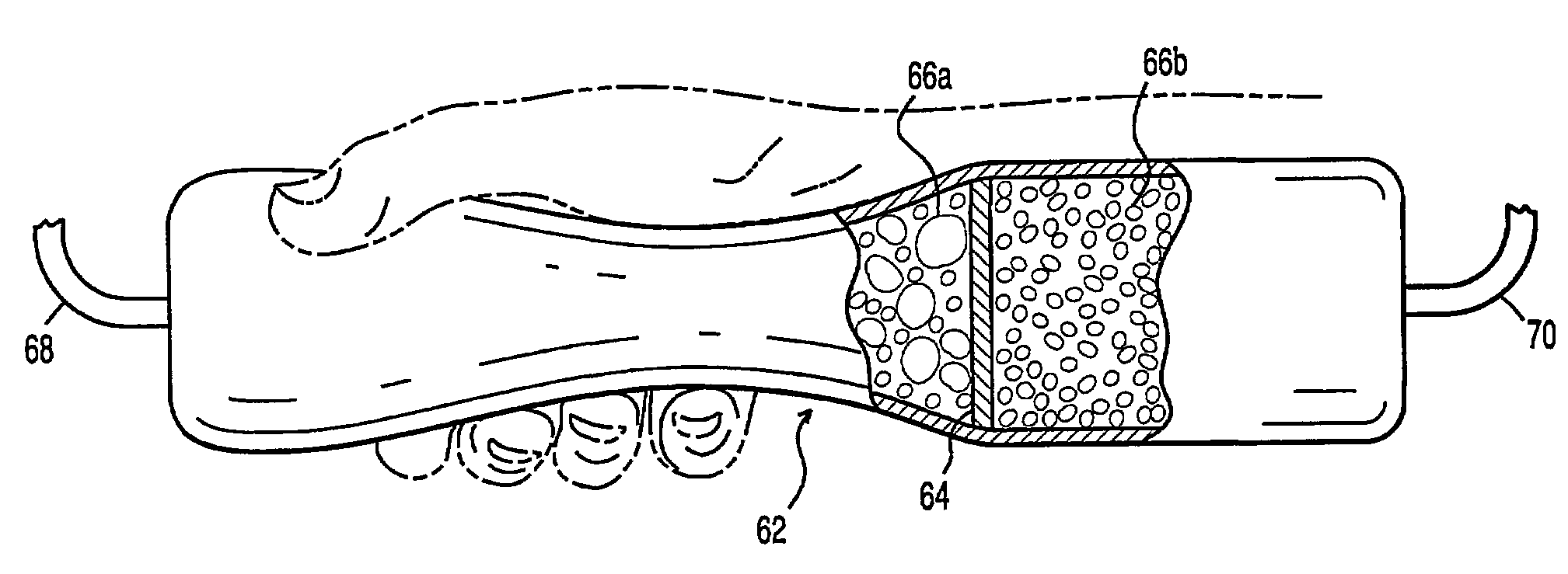 Fuel containment and recycling system