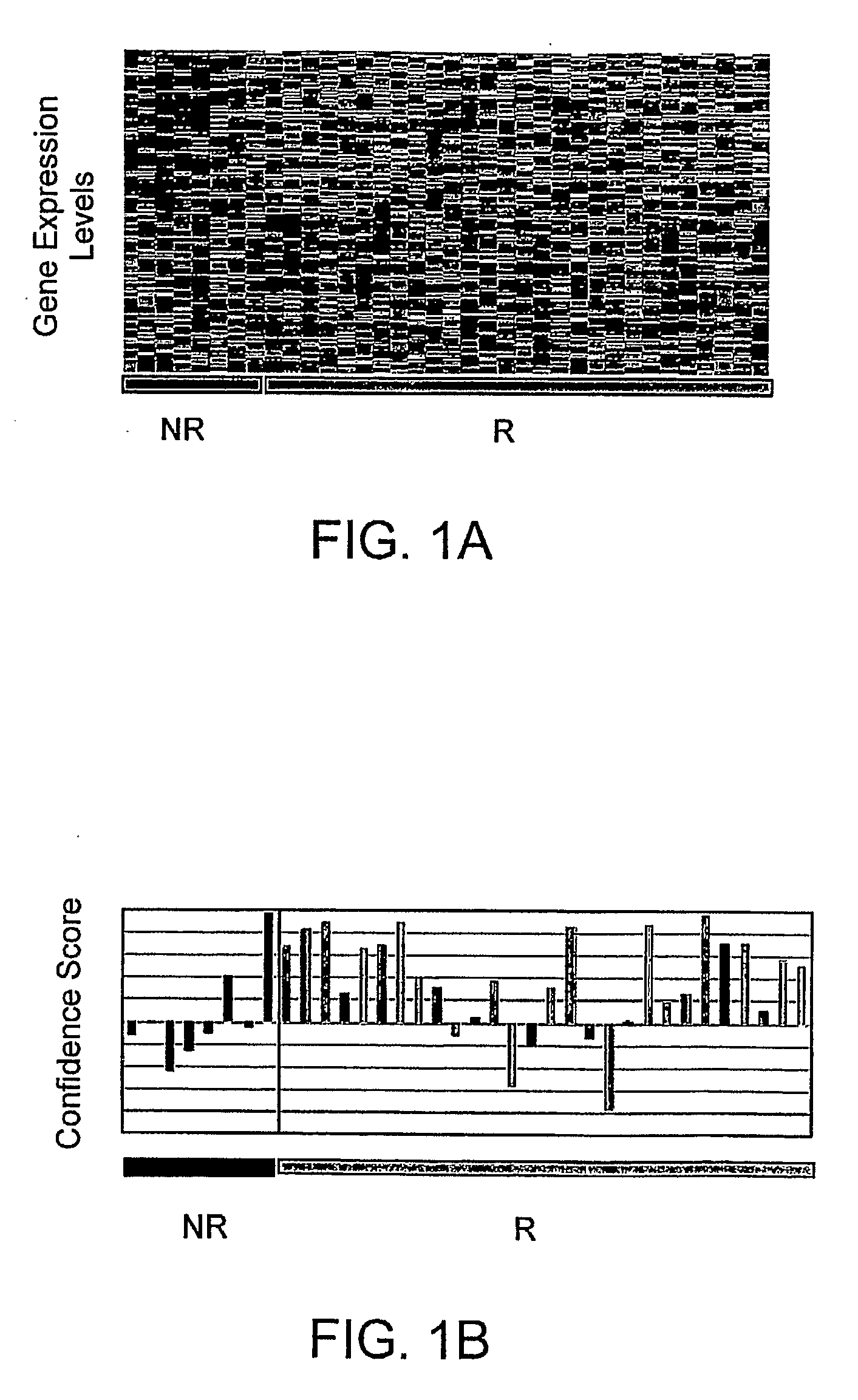 Methods and Systems for Diagnosis, Prognosis and Selection of Treatment of Leukemia