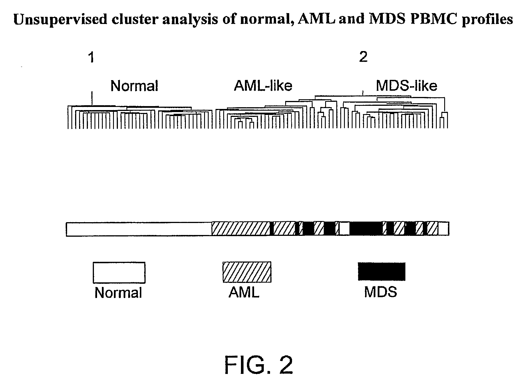 Methods and Systems for Diagnosis, Prognosis and Selection of Treatment of Leukemia