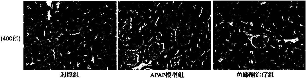 Use of tubatoxin in preparation of drugs treating acute kidney injury